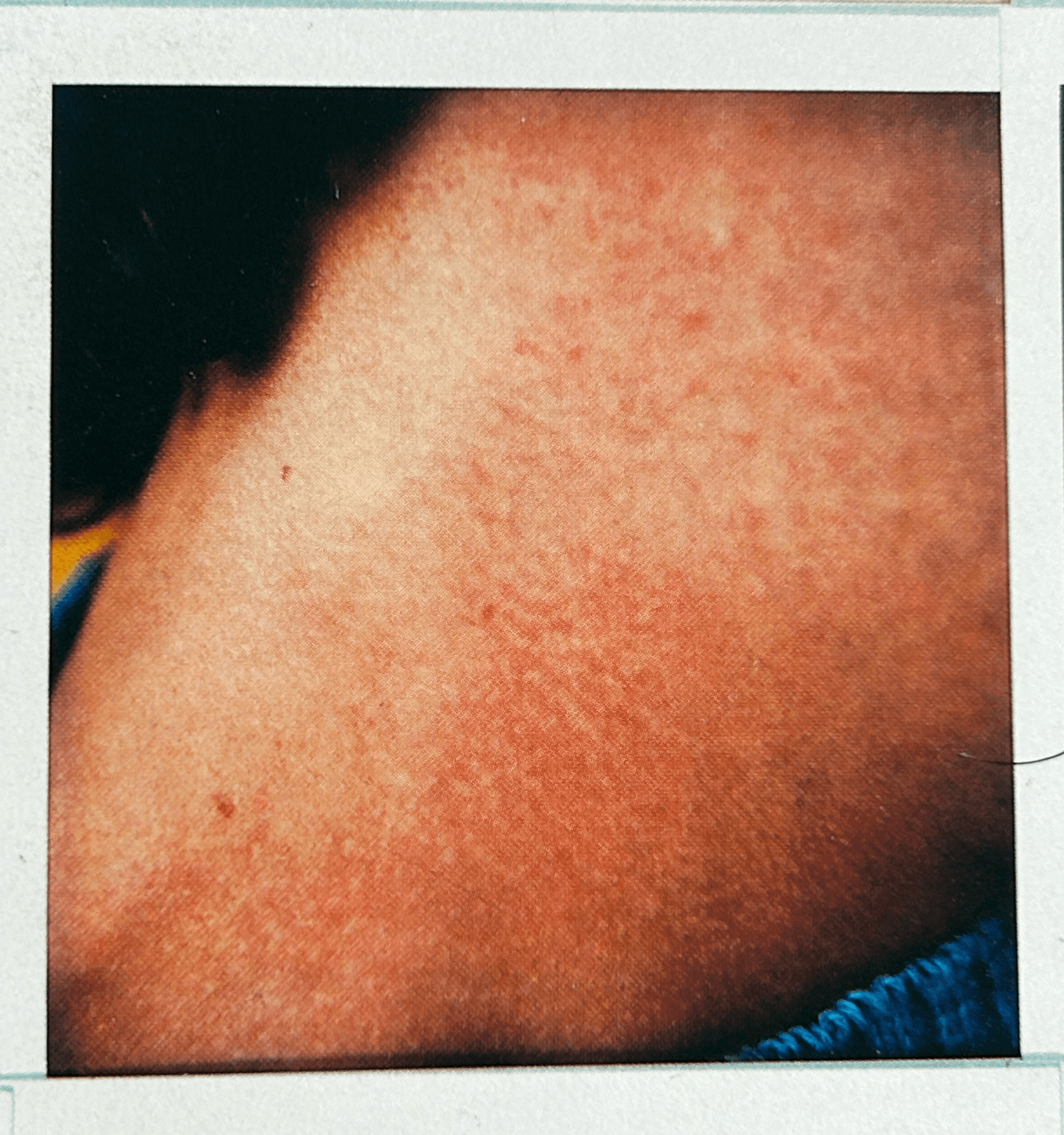 gregory, los angeles march 1982